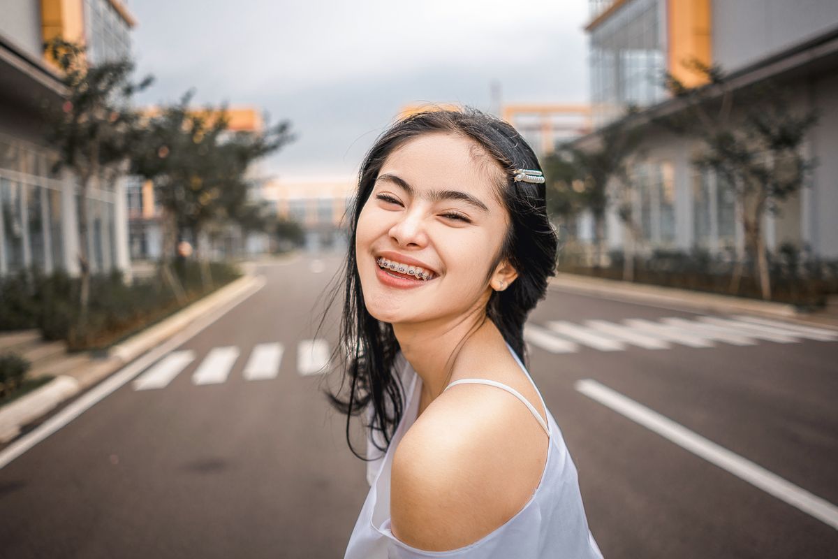 Teeth whitening with braces retainers and veneers