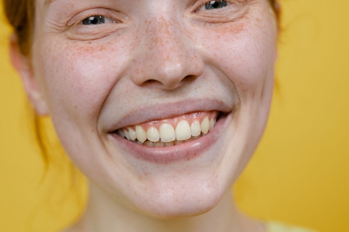 Yellow teeth versus stained teeth